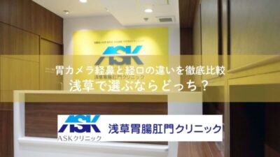 胃カメラ経鼻と経口の違いを徹底比較｜浅草で選ぶならどっち？のアイキャッチ画像