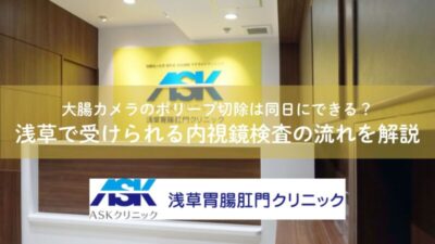 大腸カメラのポリープ切除は同日にできる？浅草で受けられる内視鏡検査の流れを解説のアイキャッチ画像