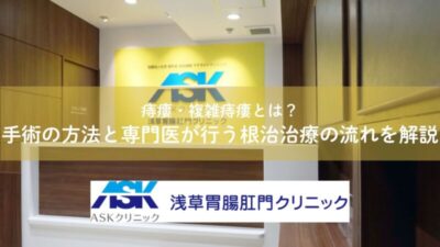 痔瘻・複雑痔瘻とは？手術の方法と専門医が行う根治治療の流れを解説のアイキャッチ画像