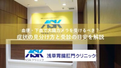 血便・下血で大腸カメラを受けるべき？症状の見分け方と受診の目安を解説のアイキャッチ画像