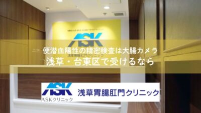 便潜血陽性の精密検査は大腸カメラ｜浅草・台東区で受けるならのアイキャッチ画像