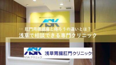 肛門周囲膿瘍と痔ろうの違いとは？浅草で相談できる専門クリニックのアイキャッチ画像